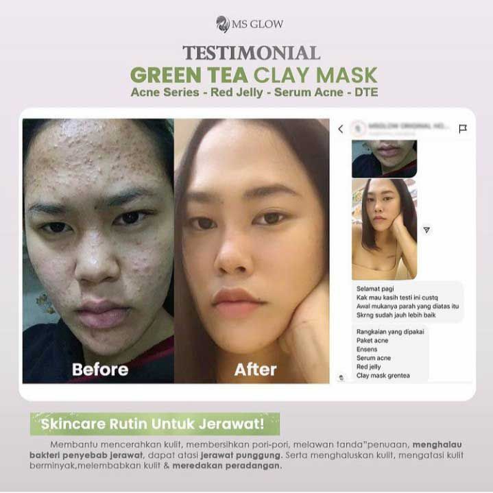 MS Glow Pore Clay Mask Green Tea - 4