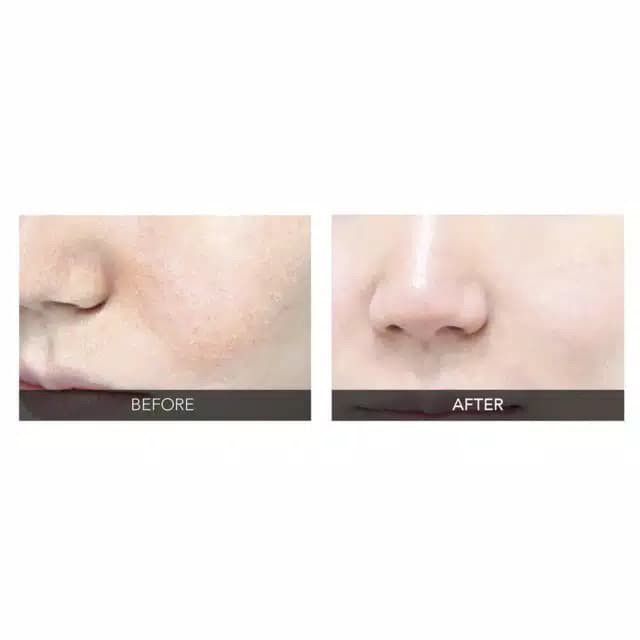 So Natural Red Peel Tingle Serum Original - 35 Ml - 2